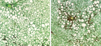 liver fibrosis (red) in mouse treated with Notch inhibitor vs control